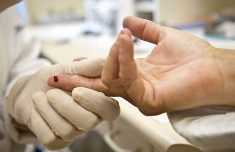 Justiça proíbe exigência de teste HIV para concursos