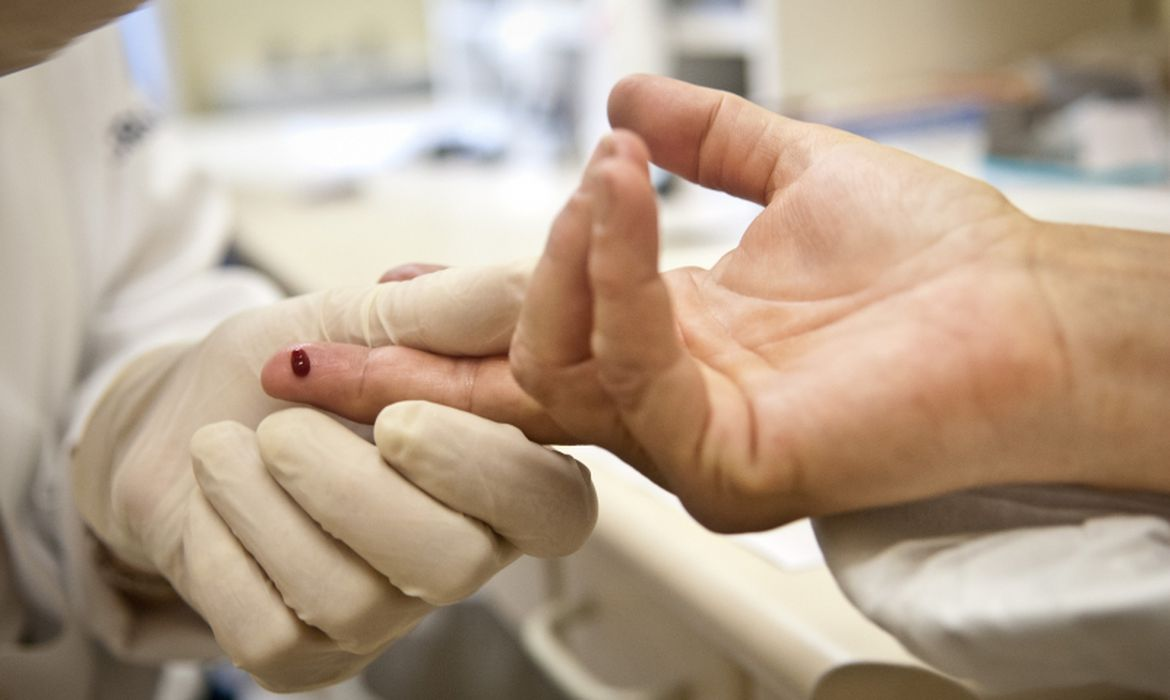 Justiça proíbe exigência de teste HIV para concursos